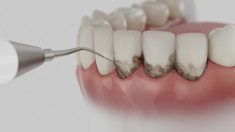 Reliable Emergency Dentist contractor in Park River, ND by Smile Center Dentistry